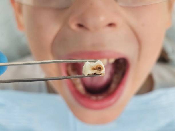 Best Same-Day Emergency Dentist in Oquawka, IL